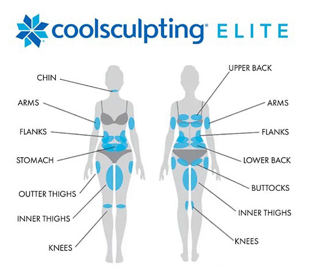 CoolSculpting Elite treatment applicator