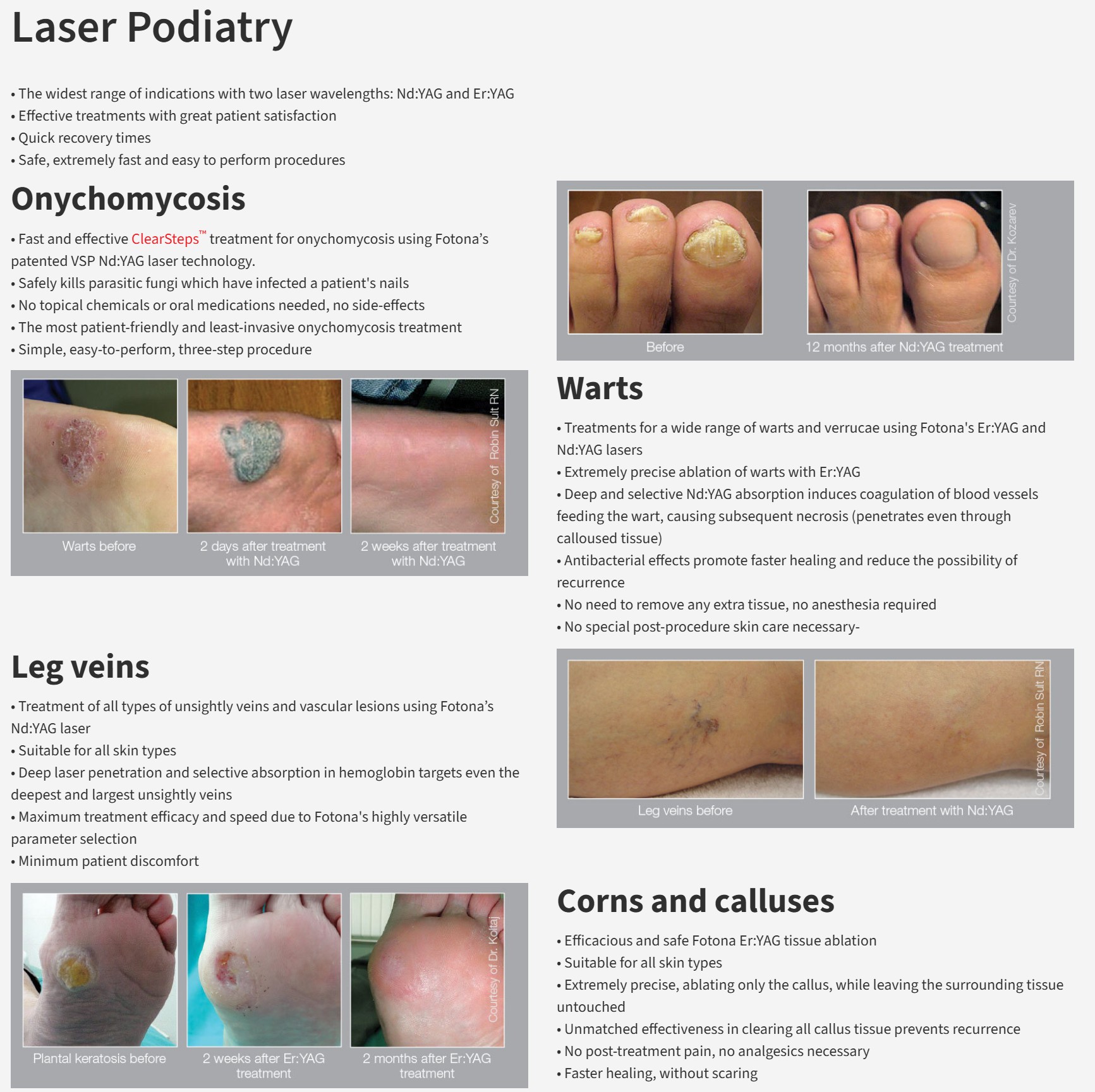 Laser Podiatry Treatment